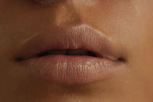 8 Causes Of Chapped Lips And 8 Ways To Prevent Them
